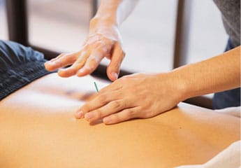 Practitioner inserting an acupuncture needle into a person's lower back.